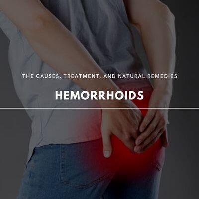 Hemorrhoids 101: The Causes, Treatment, and Natural Relief Tips