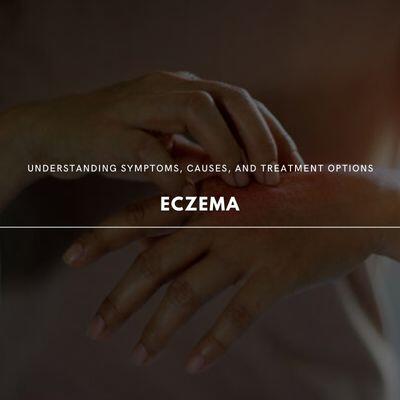 Understanding Eczema: Symptoms, Causes, and Treatment Options