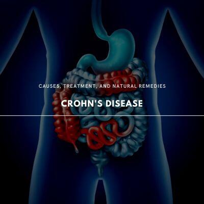 Crohn's Disease: Causes, Treatments, and Holistic Approaches