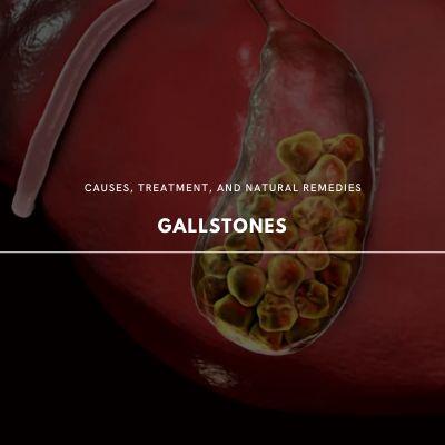 Understanding Gallstones: Causes, Treatment & Natural Remedies